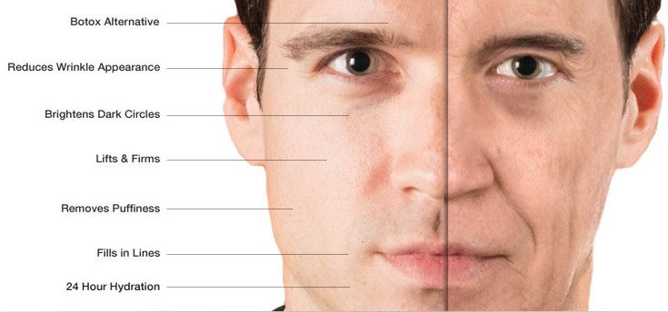 Wrinkles on Men's Faces