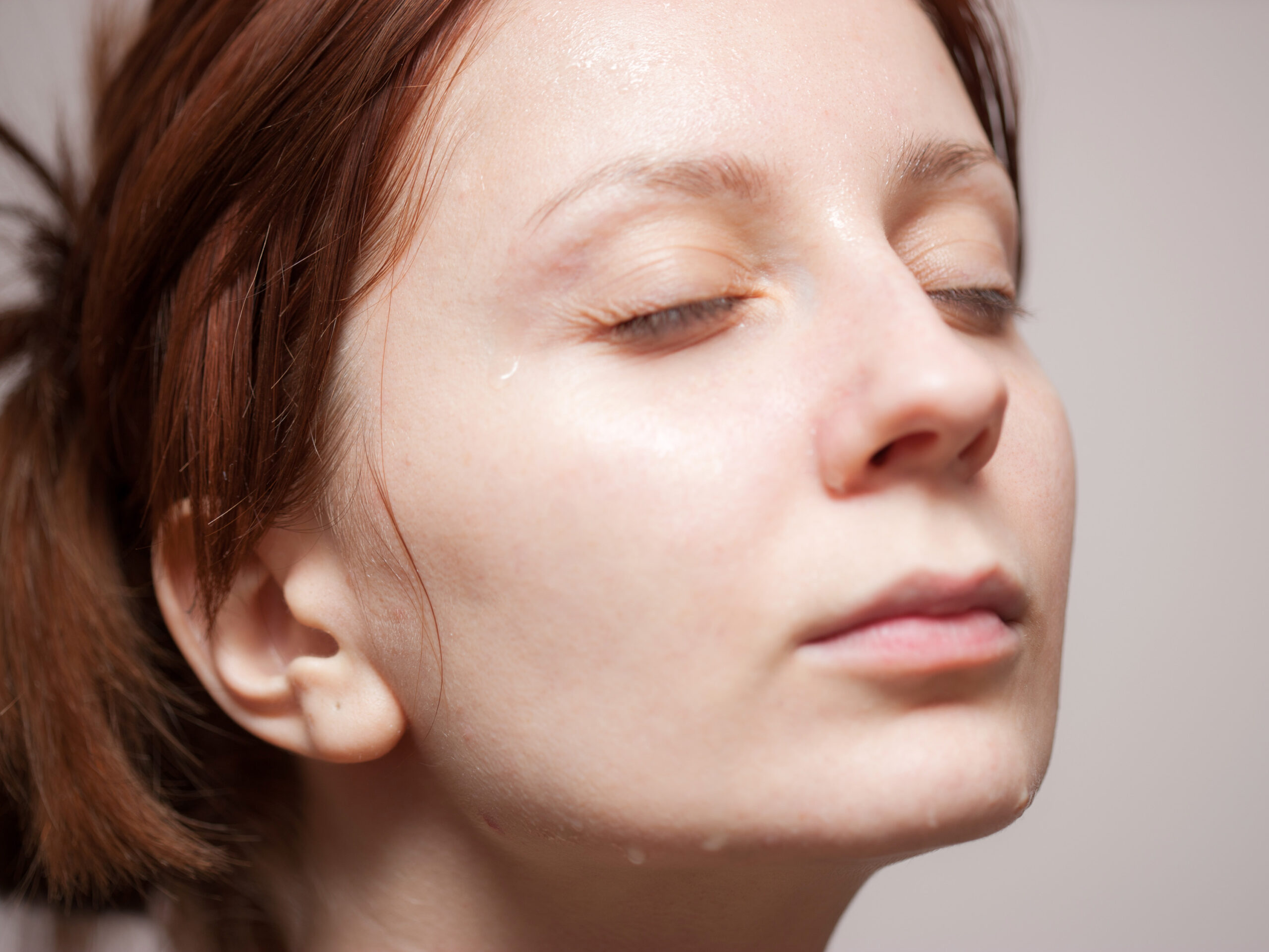 4 Best Vitamins For Dry Skin Which Can Help Moisturize Your Skin