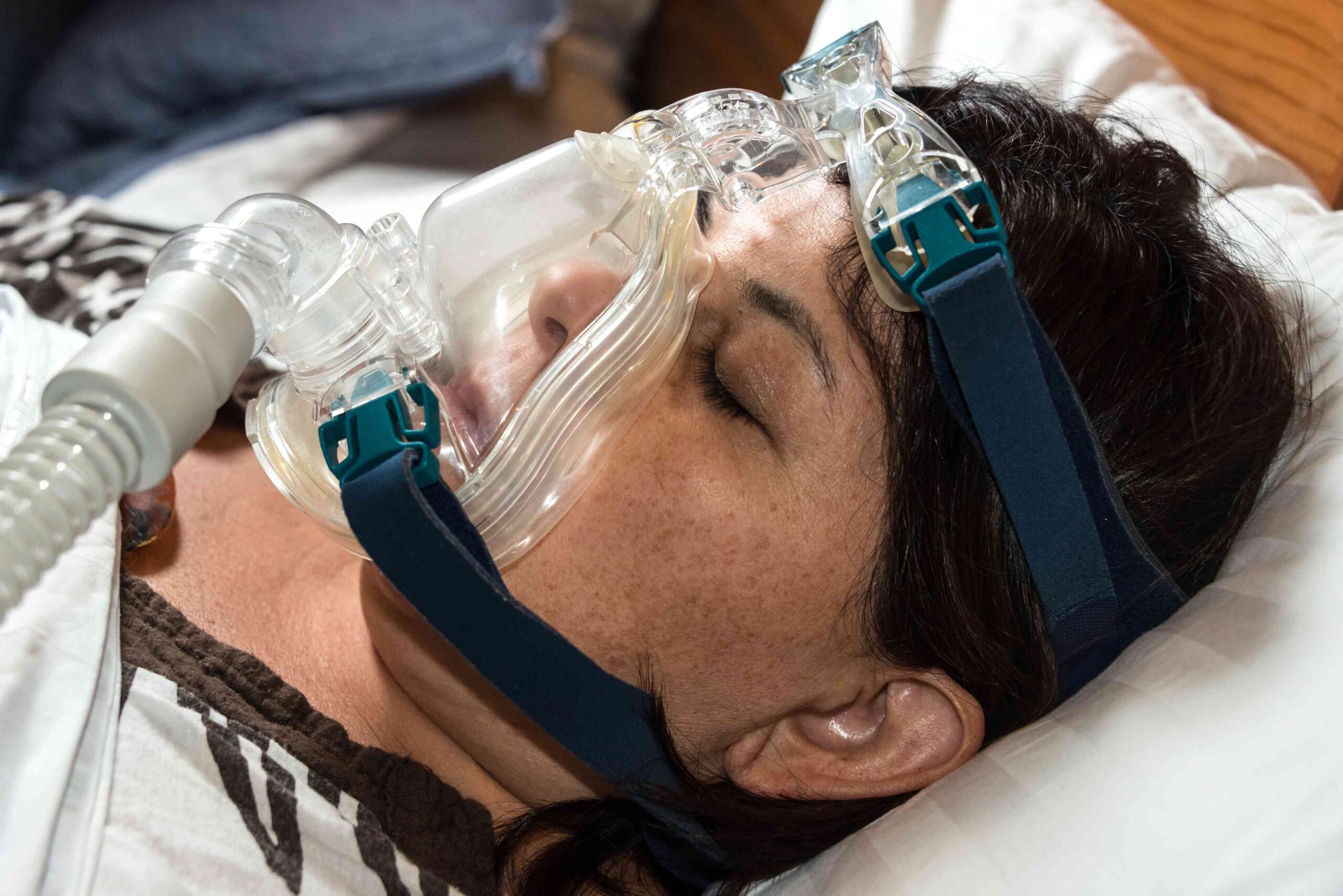 Preparation before undergoing CPAP therapy
